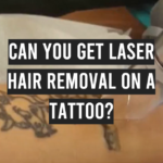 Can You Get Laser Hair Removal on a Tattoo?