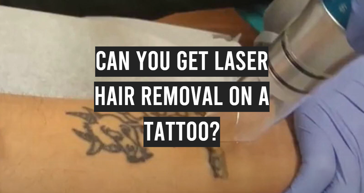 Can You Get Laser Hair Removal on a Tattoo?