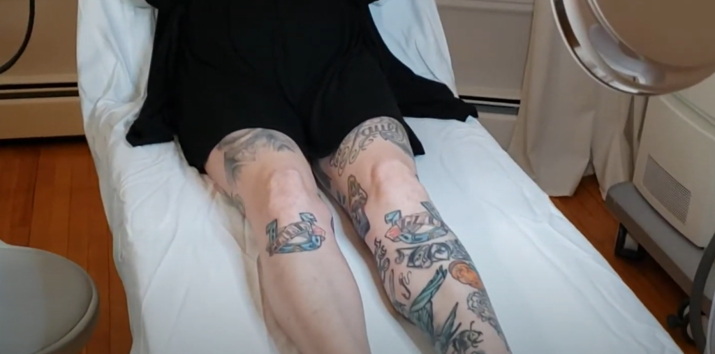 Will hair removal cream damage a tattoo?