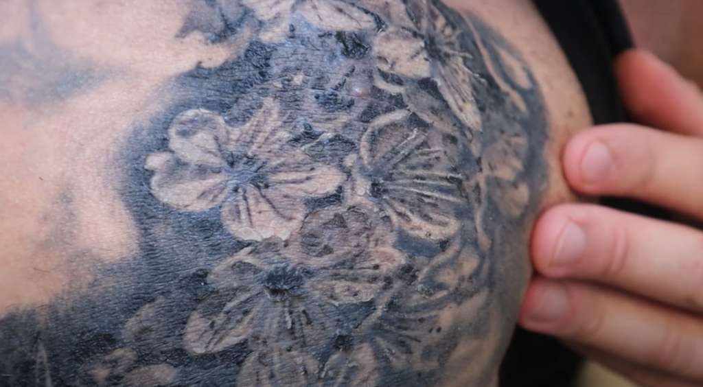 5. How to Prevent Peeling in a New Tattoo - wide 4