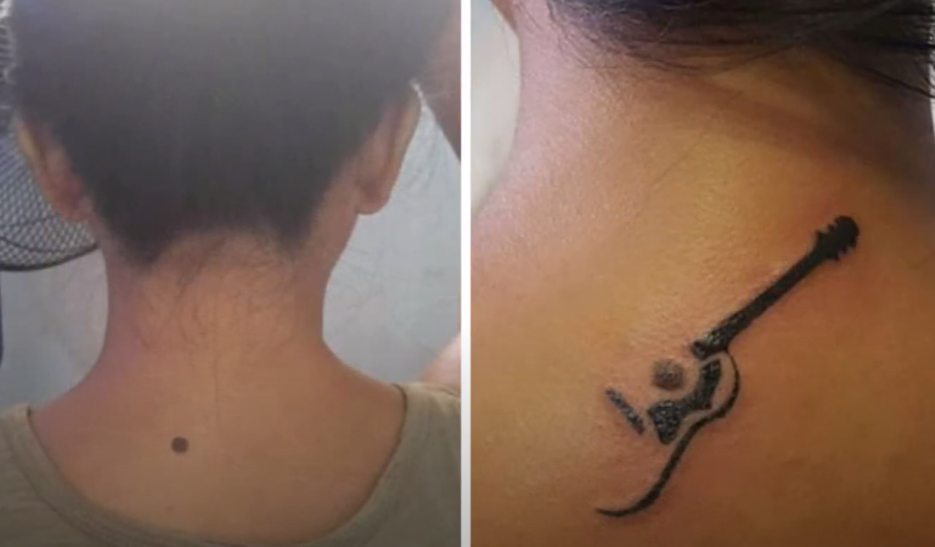 Can You Tattoo Over a Mole? TattooProfy