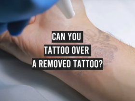 Can You Tattoo Over a Removed Tattoo?