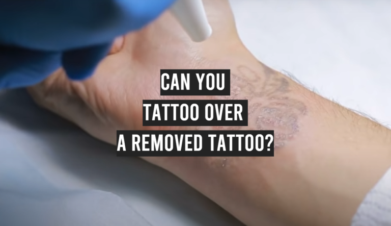 Can You Tattoo Over a Removed Tattoo? - TattooProfy