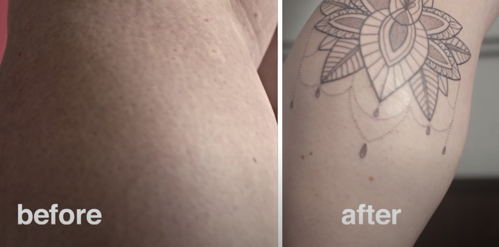 Can You Tattoo Over Stretch Marks Tattooprofy 