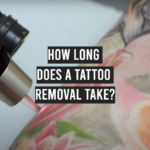 How Long Does a Tattoo Removal Take?