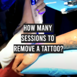 How Many Sessions to Remove a Tattoo?