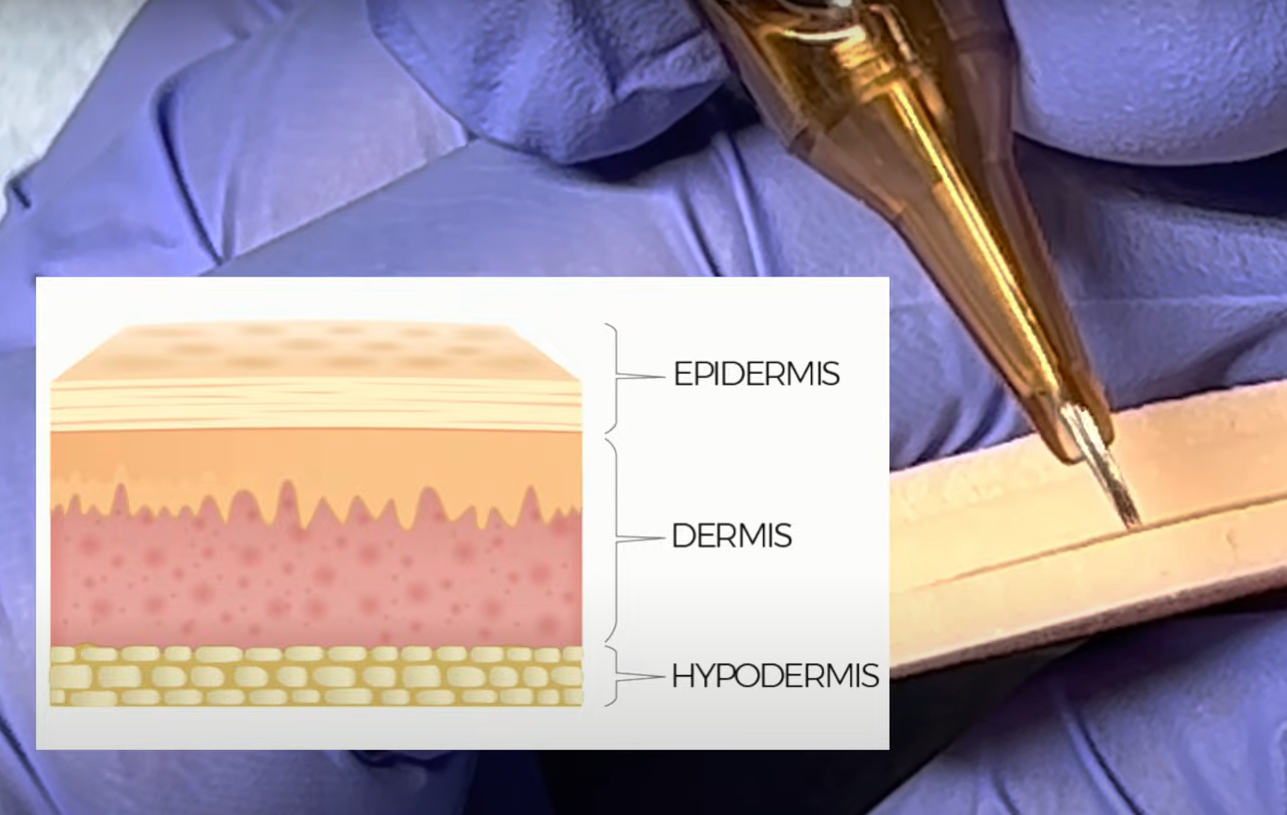 What Is a Tattoo Blowout? TattooProfy