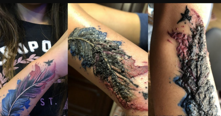 Why Is My Tattoo Raised? - TattooProfy