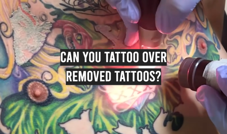 Can You Tattoo Over Removed Tattoos? - TattooProfy