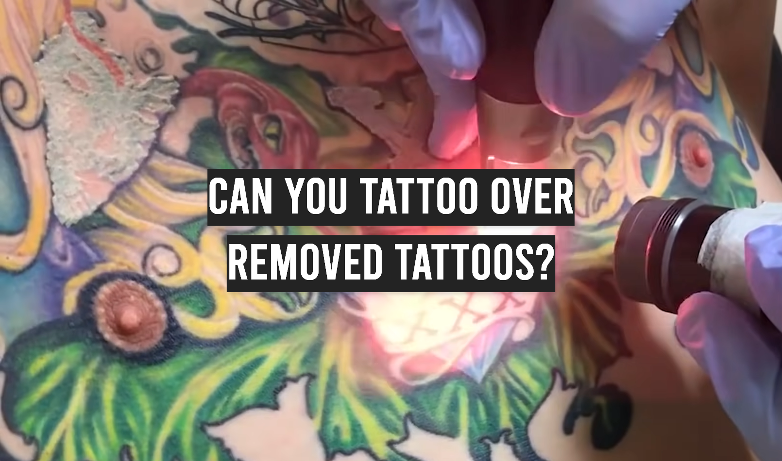 How To Remove a Tattoo You Regret  Man of Many