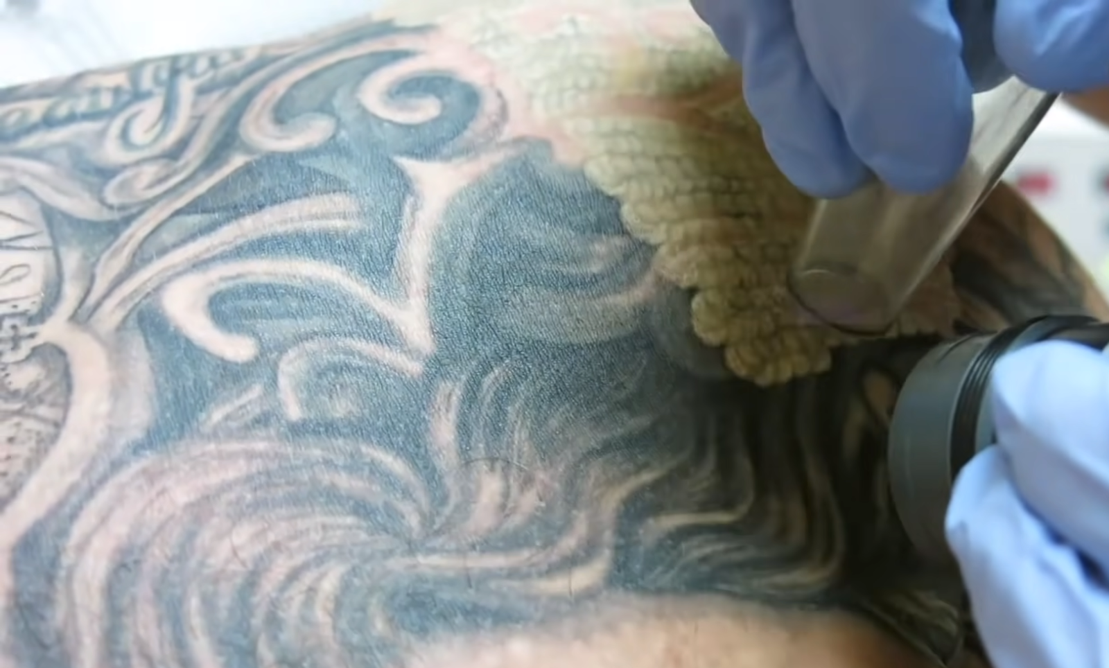 Can You Tattoo Over Removed Tattoos? - TattooProfy