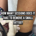 How Many Sessions Does It Take To Remove a Small Tattoo?
