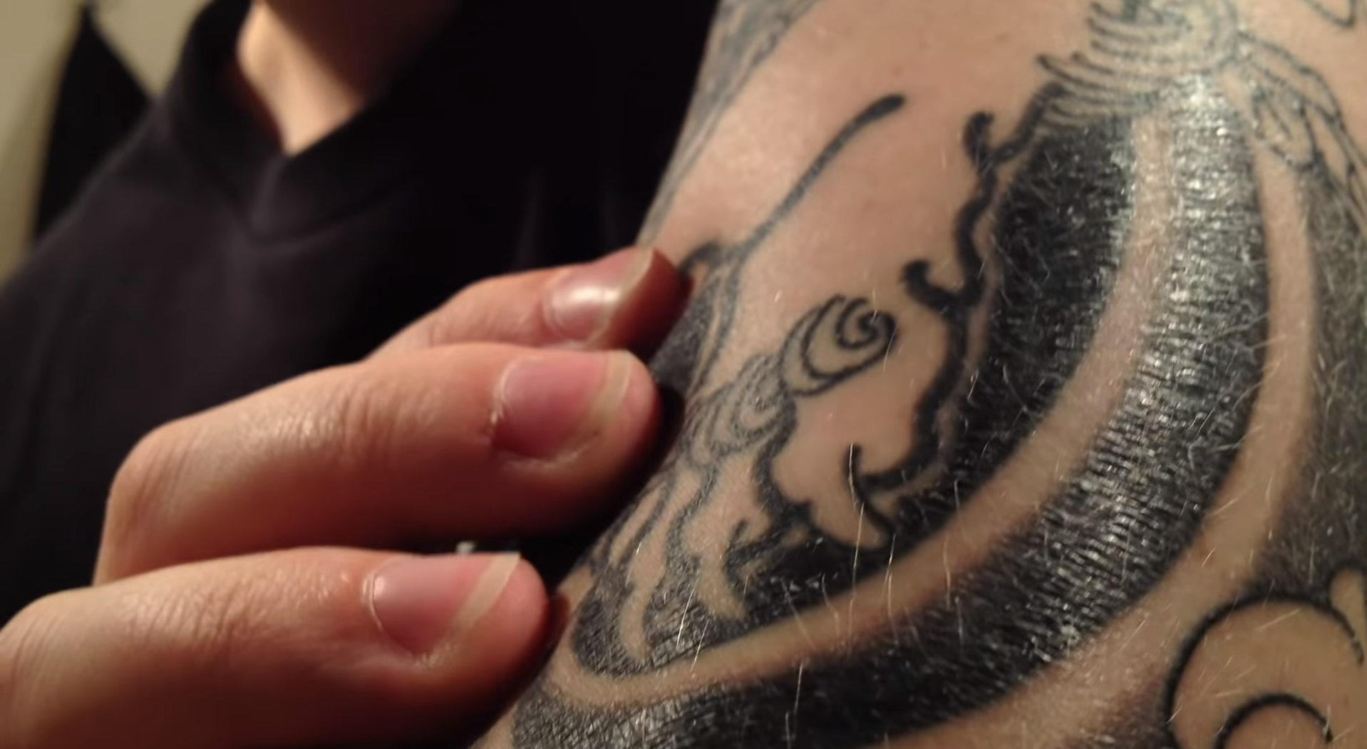 What to Do About Yellow Bruising Around Tattoo