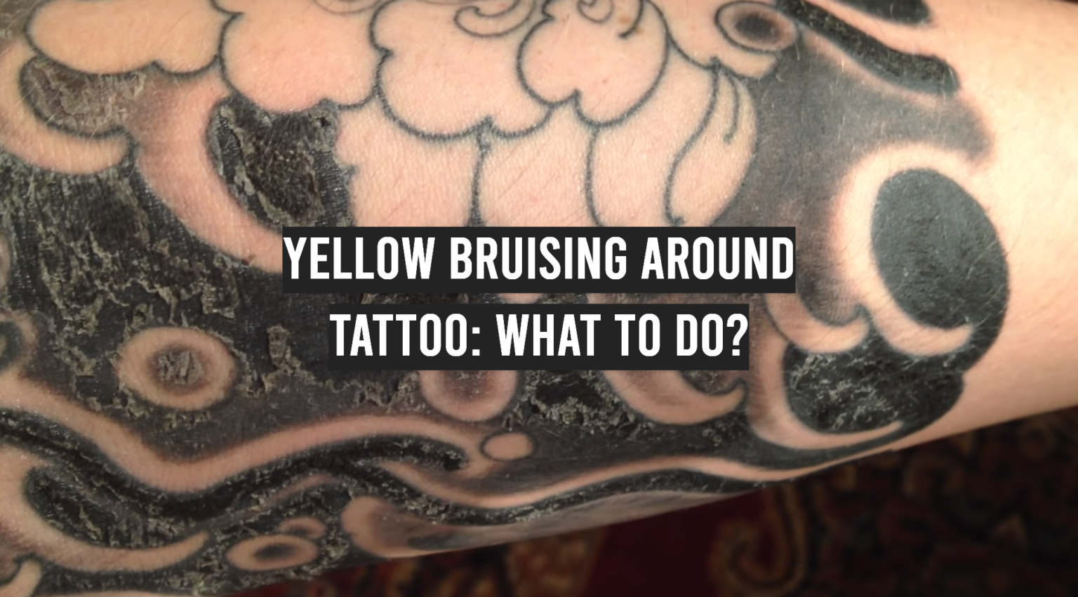 Yellow Bruising Around Tattoo What to Do? TattooProfy