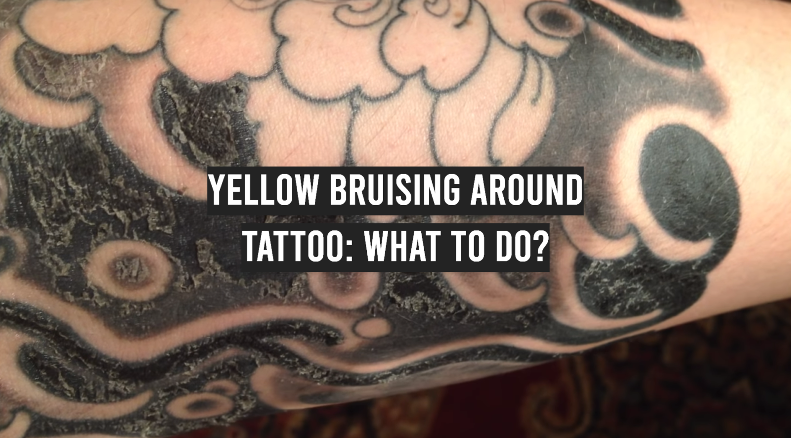 Yellow Bruising Around Tattoo: What to Do?